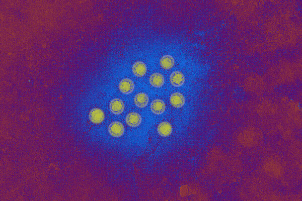 What to Know About the Hepatitis A Outbreak in L.A. County