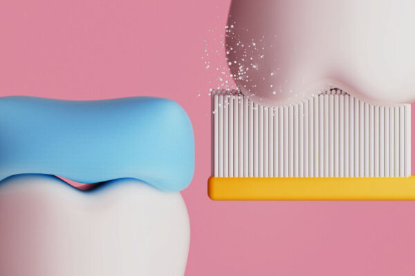 Can You Reverse Tooth Decay?